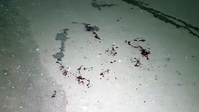 Motociclista sofre fratura exposta em acidente de trânsito no Bairro Periolo