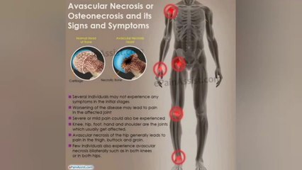 PrP or stem cell treatment সবচেয়ে ভালো চিকিৎসা কোনটি জেনে নিন ২০২১