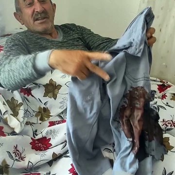 Kütahya’da ayı saldırısına uğrayan kişi: ‘Ben sana ne yaptım kocaoğlan’ dedim
