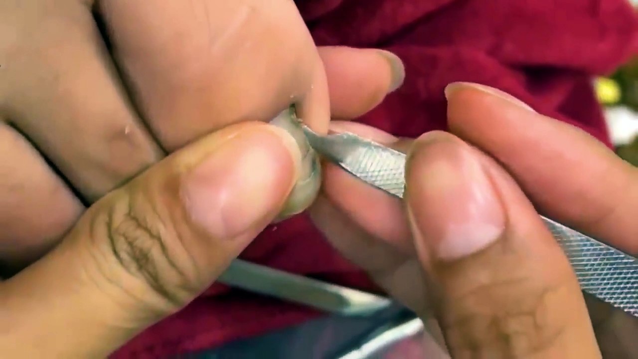 HOW TO CUT THICK TOENAILS - Toenail Cleaning Satisfying #14