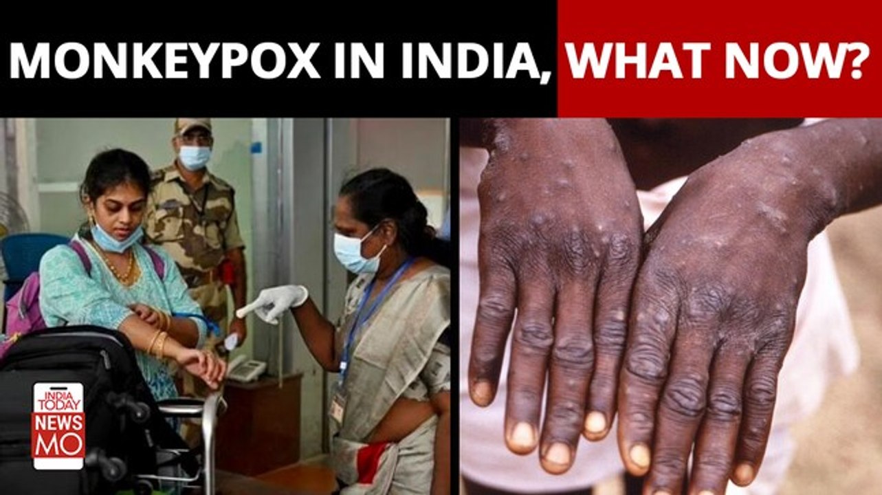 Monkeypox in India, what now?