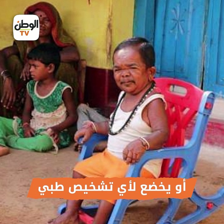 قصة رجل بوجه طفل :  عنده 50 سنة والناس تزوره لت...