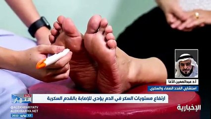 فيديو استشاري الغدد الصماء والسكري عبدالمعين الآغا التحكم بالسكر أحد أهم سبل الوقاية من الإصابة بالقدم السكرية - - نشرة_النهار - الإخبارية