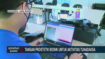 Start Up Binaan ITB, Karla Bionics Ciptakan Tangan Palsu Prostetik untuk Bantu Aktivitas Tunadaksa