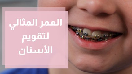العمر المناسب لتقويم الأسنان