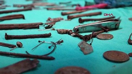 Van'da kadın hastanın midesinden 158 parça metal çıktı