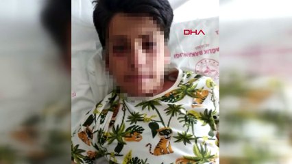 Ses bombası yapımı izleyip evde denedi: Dehşet kaçınılmaz oldu
