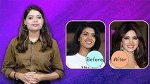 Priyanka Chopra Nose Surgery Before After इतनी बदली, Must Watch Video | Bodlsky*Lifestyle