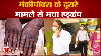 Monkeypox Case: केरल में मंकीपॉक्स के एक और केस की पुष्टि, देश में अब तक मिले इस वायरस से दो पीड़ित