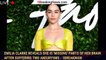 Emilia Clarke reveals she is 'missing' parts of her brain after suffering two aneurysms - 1breakingn