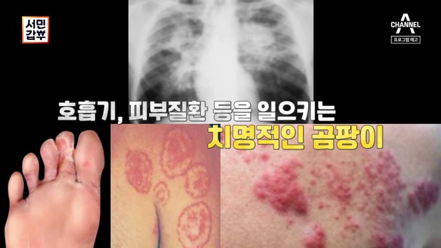 [예고] 여름 불청객 ※곰팡이 걱정 STOP!※ 집을 치료하는 주치의 갑부⁉