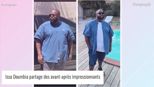 Issa Doumbia aminci : des avant-après dévoilés, même chemise mais pas la même époque