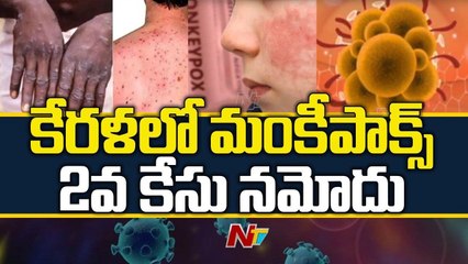 Monkeypox Second Case Reported in Kerala _ Ntv
