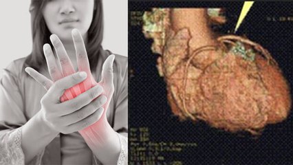 Left Hand Pain Kyun Hota hai | बाएं हाथ में दर्द होता है जानलेवा | Boldsky *Health