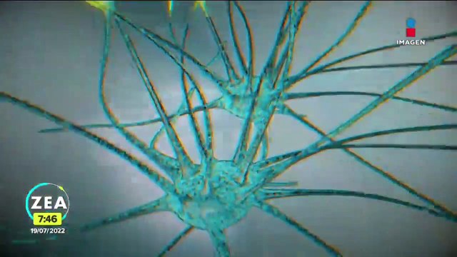 Las neuronas y su papel en la salud mental