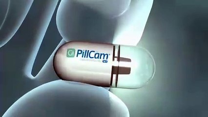 Mulher morre durante endoscopia: entenda se exame traz risco aos pacientes