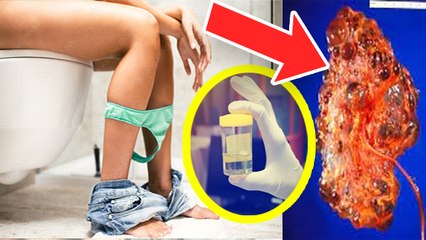 Clear Urine Kidney Failure का Symptom, नजरअंदाज करना जानलेवा Expert Advice | Boldsky *Health