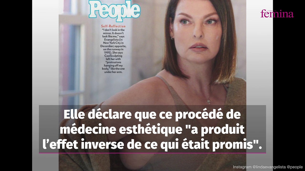 Linda Evangelista défigurée par la chirurgie : elle dévoile son nouveau visage après des années à le cacher et brise le silence