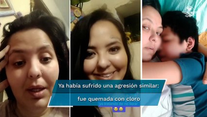 Luz Raquel presentó denuncias por amenazas de muerte antes de ser quemada