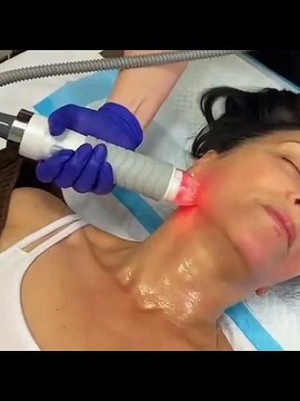 QWO Cellulite Treatment