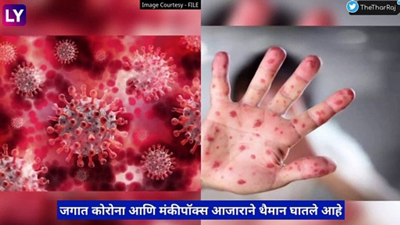 Congo Hemorrhagic Fever: काँगो फिव्हर या जीवघेण्या तापाचा धोका, स्पेनमध्ये आढळला एक रुग्ण