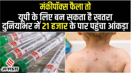 मंकीपॉक्स के लिए कितना तैयार है यूपी की योगी सरकार, क्या है केंद्र सरकार की गाइडलाइन