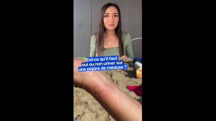 Est-ce qu'il faut oui ou non uriner sur une piqûre de méduse ?