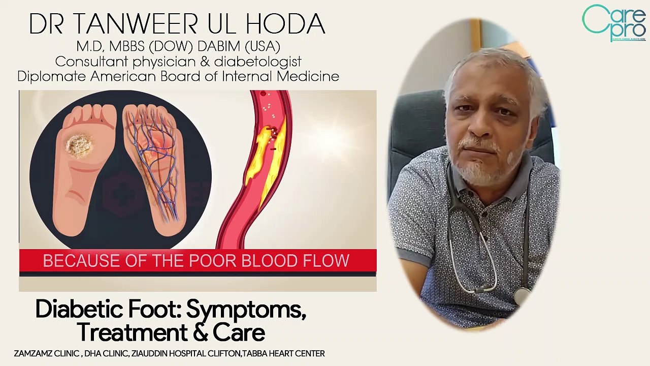 Diabetic Foot Symptoms, Treatment and Foot Care in Hindi and Urdu