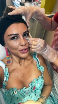 Selen Görgüzel'in ''güzellik'' itirafı olay oldu: ''Sünnet derisinden...''