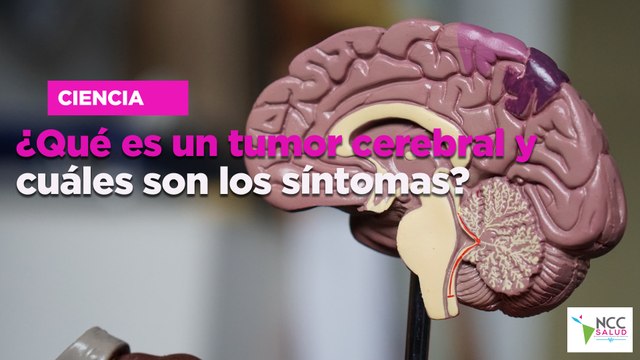 ¿Qué es un tumor cerebral y cuáles son los síntomas?