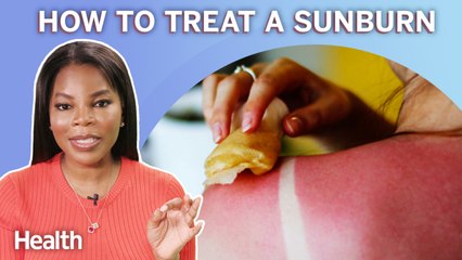 What Is Sunburn and How to Treat It, According to a Dermatologist | Ask An Expert | Health