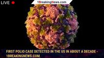 First Polio Case Detected in the US in About a Decade - 1breakingnews.com