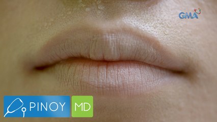 Misis, hiniwalayan daw ng kanyang mister dahil sa maputlang mga labi? | Pinoy MD