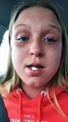 Influencer terminó con la cara desfigurada en cámara de bronceo