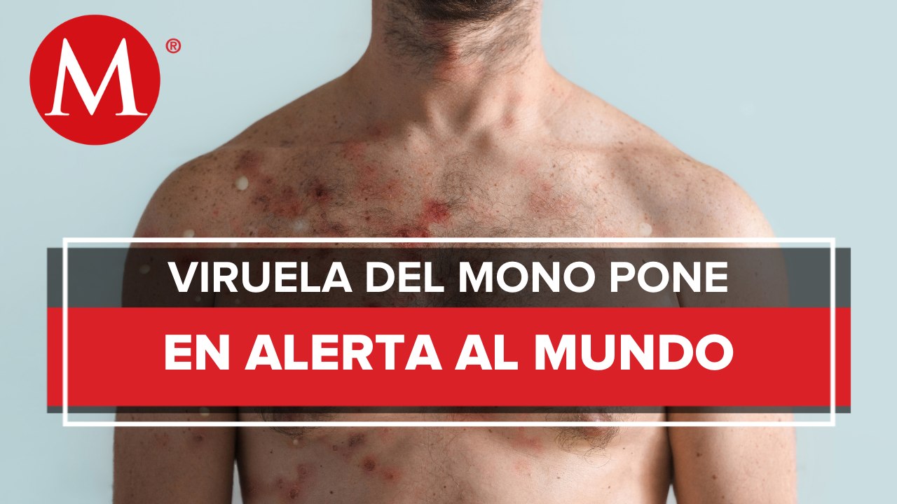 "Tiene una implicación importante para los sistemas de salud de todo el mundo": Héctor Raúl Pérez