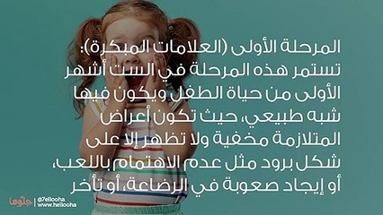 تعريف متلازمة ريت وأعراضها وكيفية التعايش معها