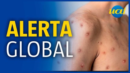 OMS declara varíola do macaco como emergência global