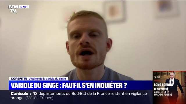 Variole du singe: faut-il s'en inquiéter?