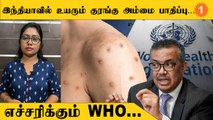 Monkey Pox பரவல் தீவிரமாகிறதா? | Health