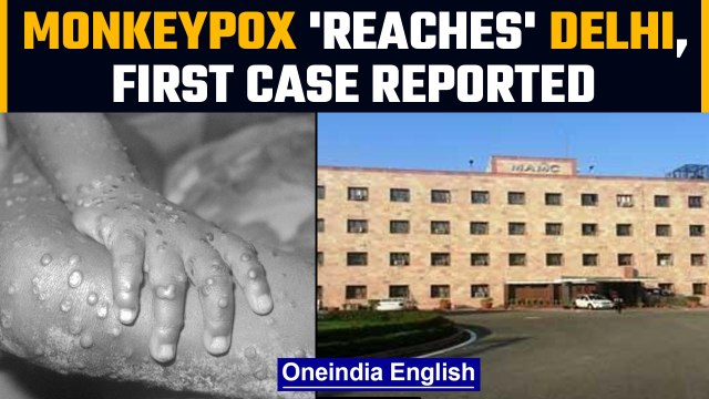 Monkeypox: Man with no travel history tests positive, first case in Delhi | Oneindia news *News