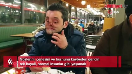 Tek hayali normal insanlar gibi yaşamak