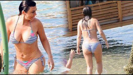 Sünnet derisinden estetik yaptıran Selen Görgüzel