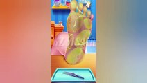 Foot Surgery Animation | ASMR Video 2022 | KZ ASMR