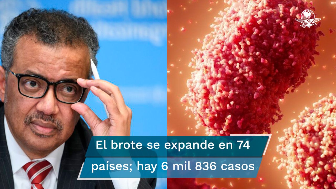 Viruela del mono: ¿Qué recomienda la OMS por alerta máxima?