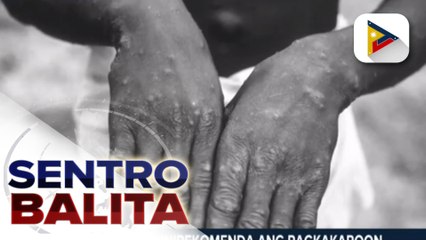 Ang pagkakaroon ng mas maraming testing centers para sa monkeypox, inirekomenda
