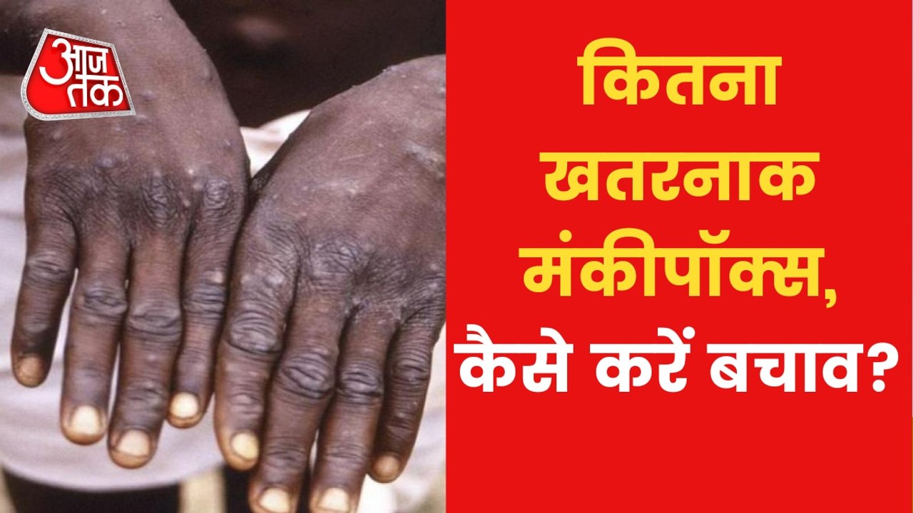 Can monkeypox spread through sexual contact?