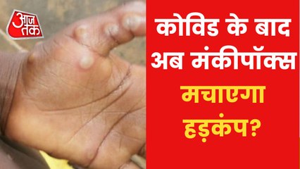 Health News: How the infection of Monkeypox spread?