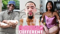 Trying To Find Love With Vitiligo | DATING DIFFERENT