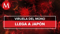 Japón reporta su primer caso de viruela del mono