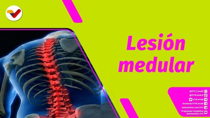 Buena Vibra | ¿Cómo tratar una lesión medular?
